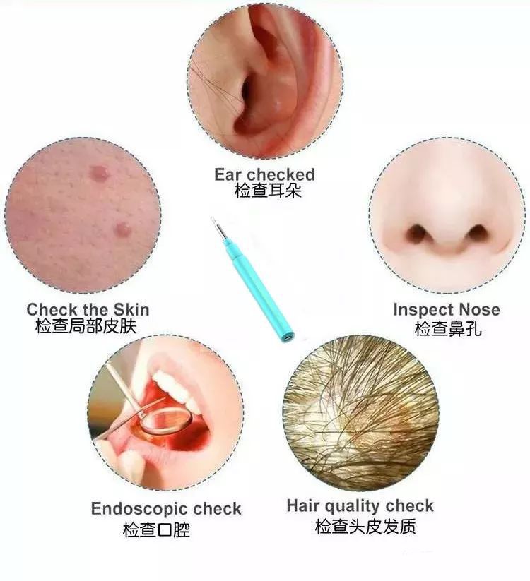 智能可視化采耳棒 智能可視化采耳棒